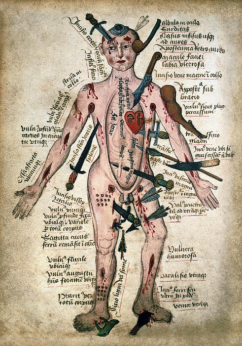 wound-man-medieval-anatomy-illustration-