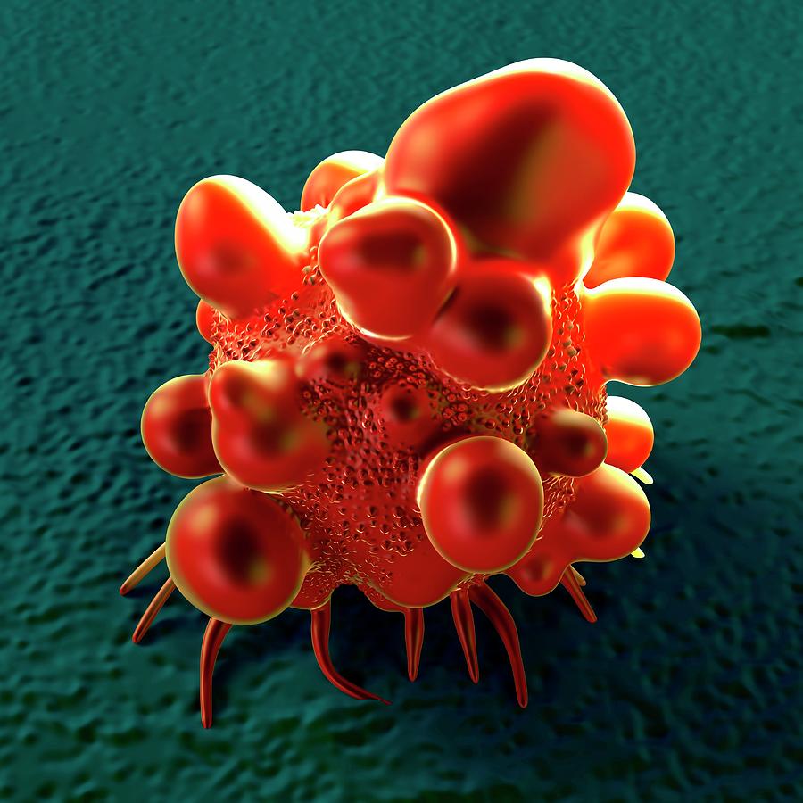 Bowel Cancer Cell Photograph By Science Artwork Pixels