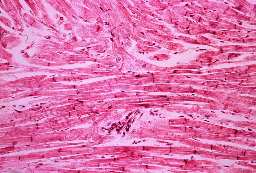 Cardiac Muscle Photograph By Cnri Science Photo Library Pixels