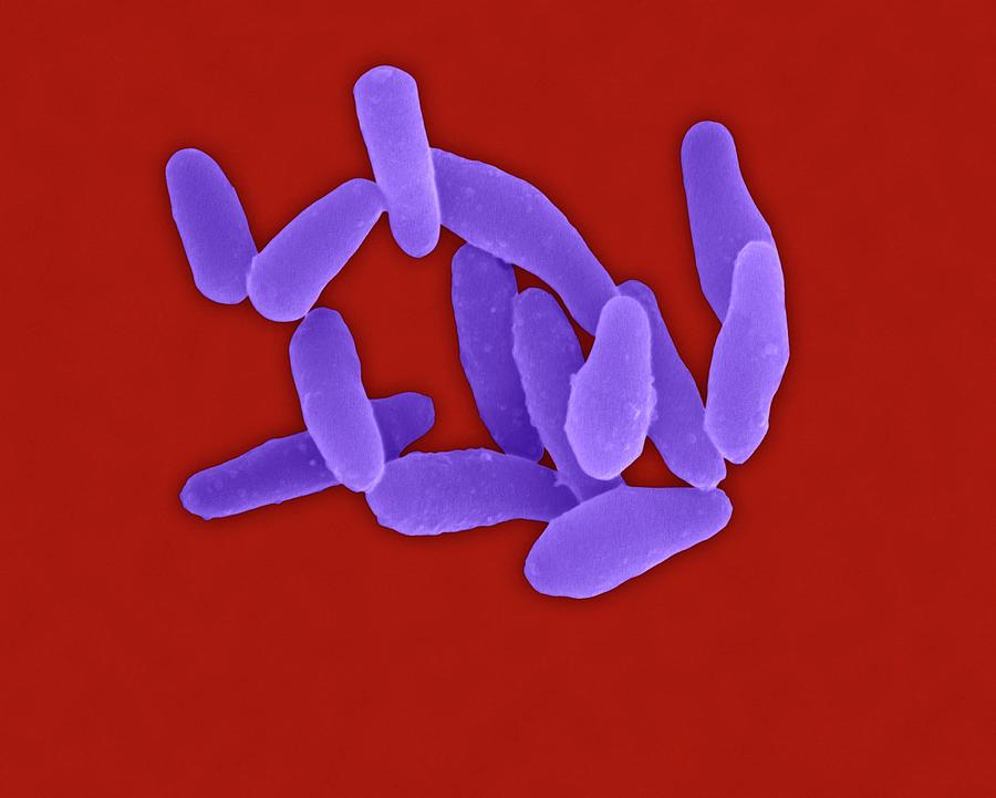 Corynebacterium Diphtheriae Photograph By Dennis Kunkel Microscopy