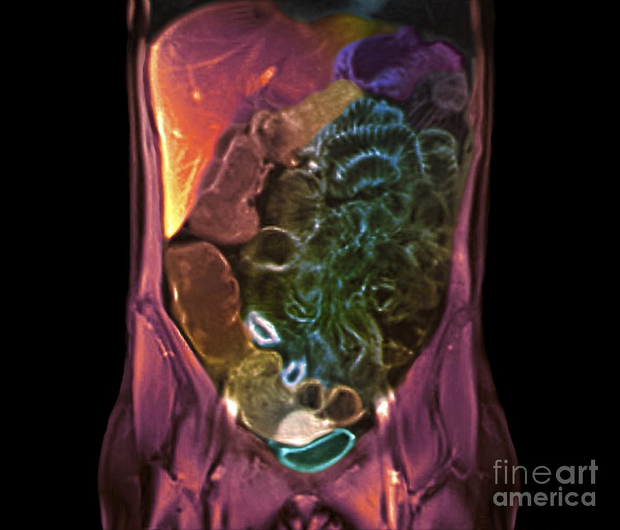 Healthy Abdomen Mri Scan Photograph By Zephyr Fine Art America