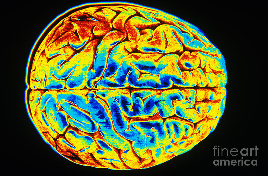 Human Brain Photograph By Scott Camazine Fine Art America