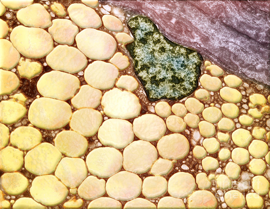 Human Fat Cells 95