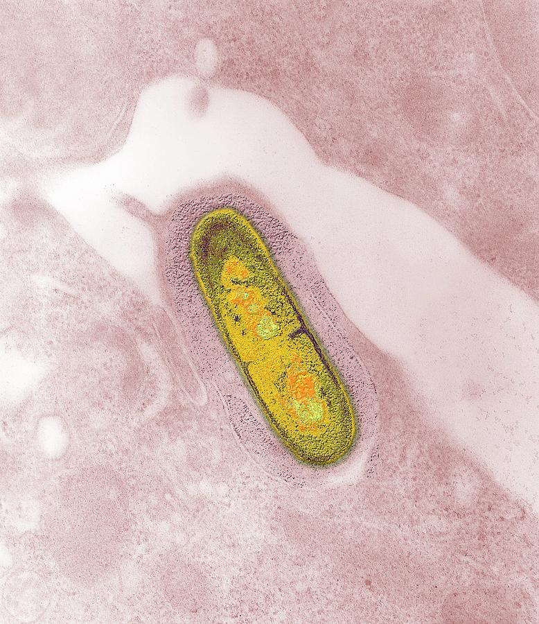 Listeria Bacteria Photograph By Ami Images Science Photo Library Fine