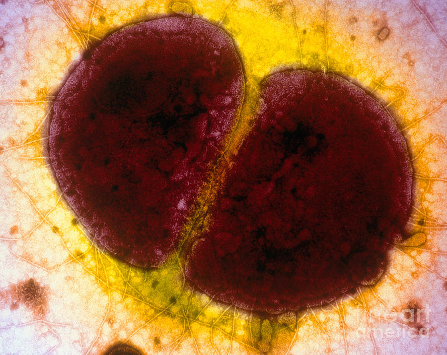гонококк в урогенитальных выделениях при микроскопии