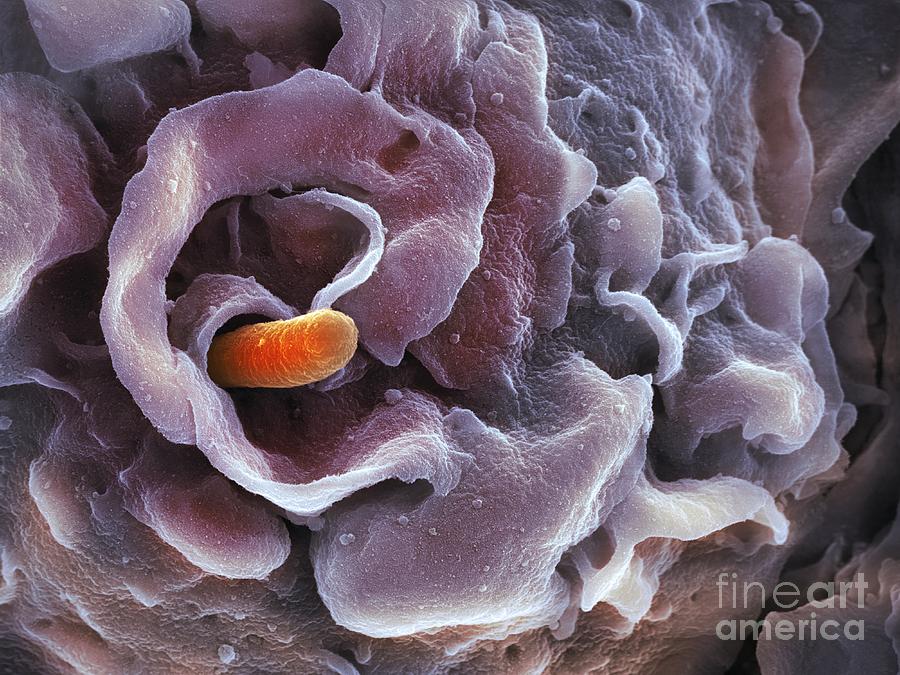 Shigella Bacterium And Macrophage Sem Photograph By Science Photo