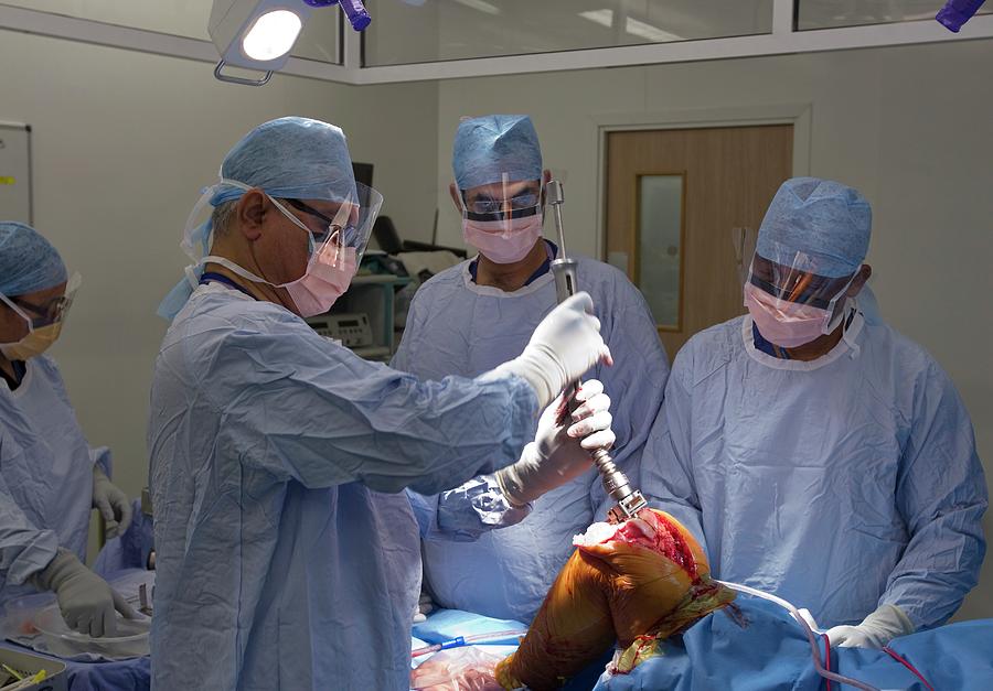 Knee Replacement Surgery Photograph By Mark Thomas Science Photo Library