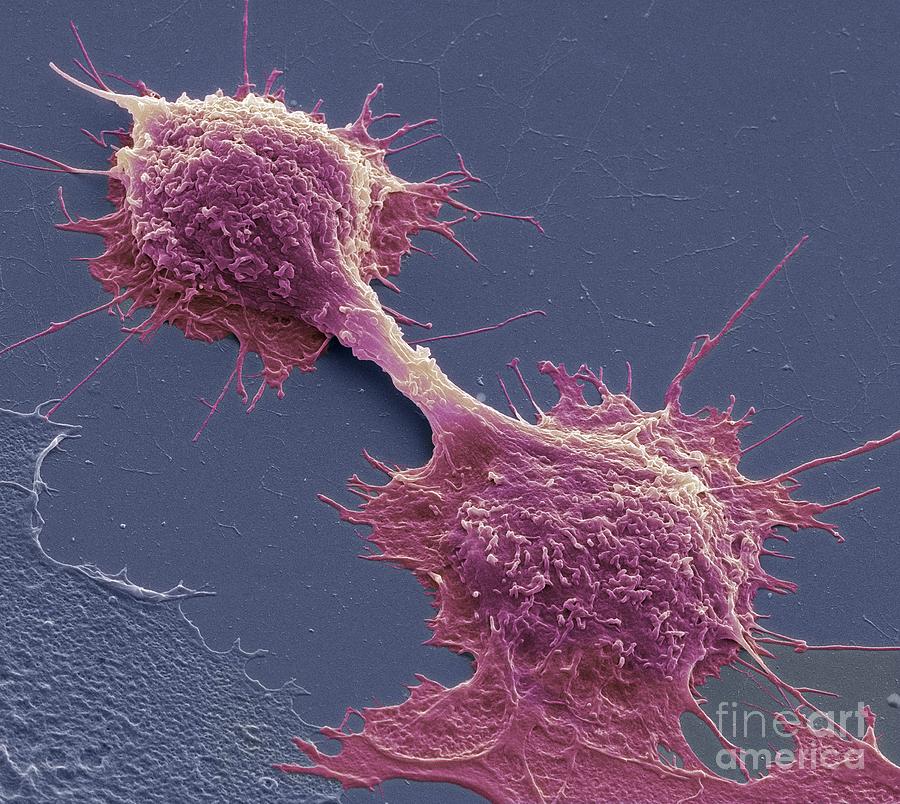 Dividing Cancer Cells Sem Photograph By Steve Gschmeissner