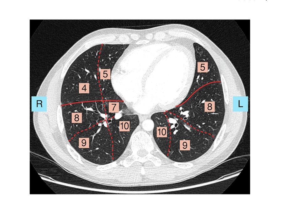 Lungs Photograph By Asklepios Medical Atlas Fine Art America