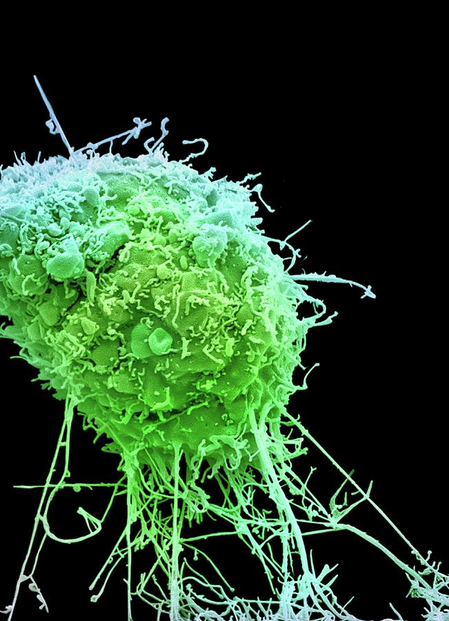 Cervical Cancer Cell Photograph By Steve Gschmeissner Pixels