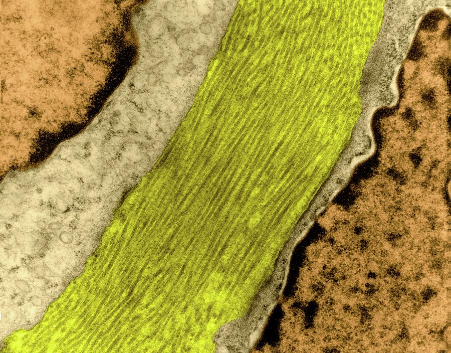 Collagen Fibres Photograph By Dennis Kunkel Microscopy Science Photo