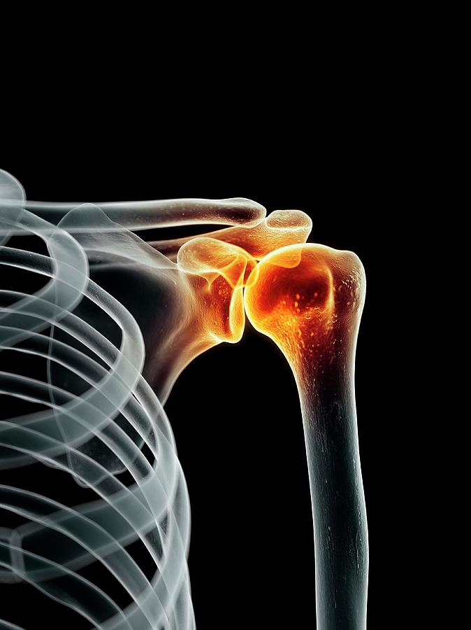 Human Shoulder Joint Photograph By Sciepro Pixels