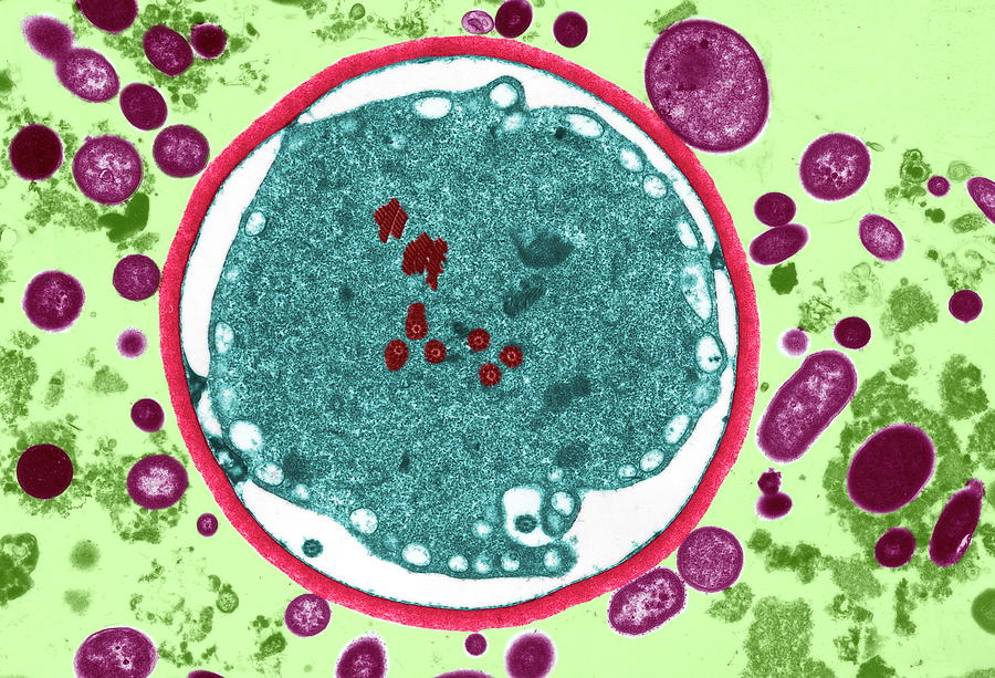 Giardia Lamblia Protozoan Photograph By Science Photo Library Pixels