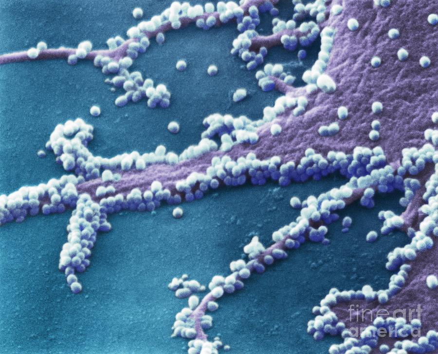 H N Flu Virus Particles Sem Photograph By Nibsc