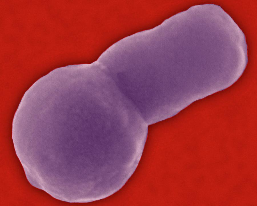 Haemophilus Influenzae Photograph By Dennis Kunkel Microscopy Science