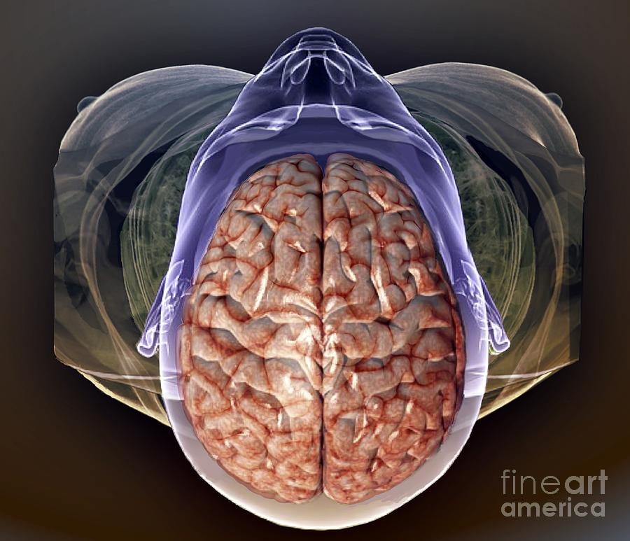 Human Head Mri And 3d Ct Scans Photograph By Zephyr Pixels