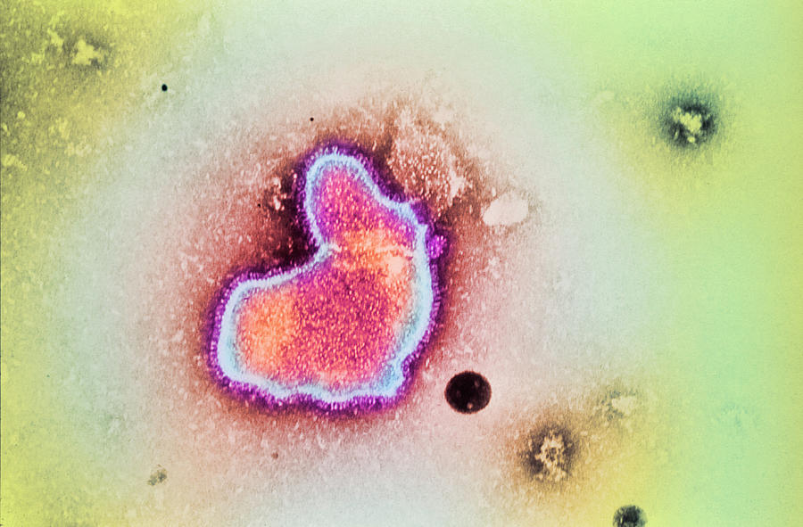 Respiratory Syncytial Virus Photograph By Cdc Science Photo Library