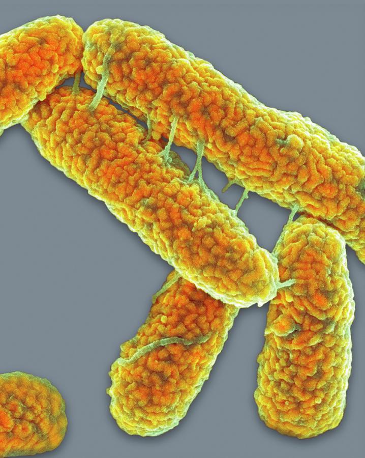 E Coli Bacteria Photograph By Science Photo Library Pixels