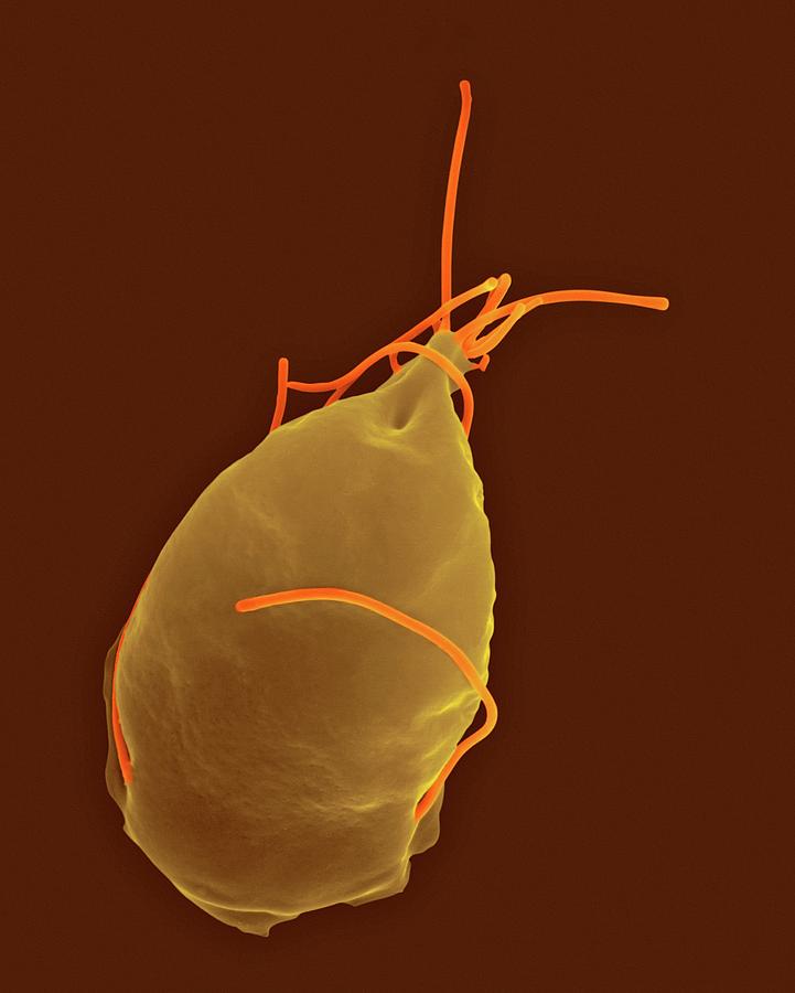 Giardia Lamblia Photograph By Dennis Kunkel Microscopy Science Photo Library Pixels