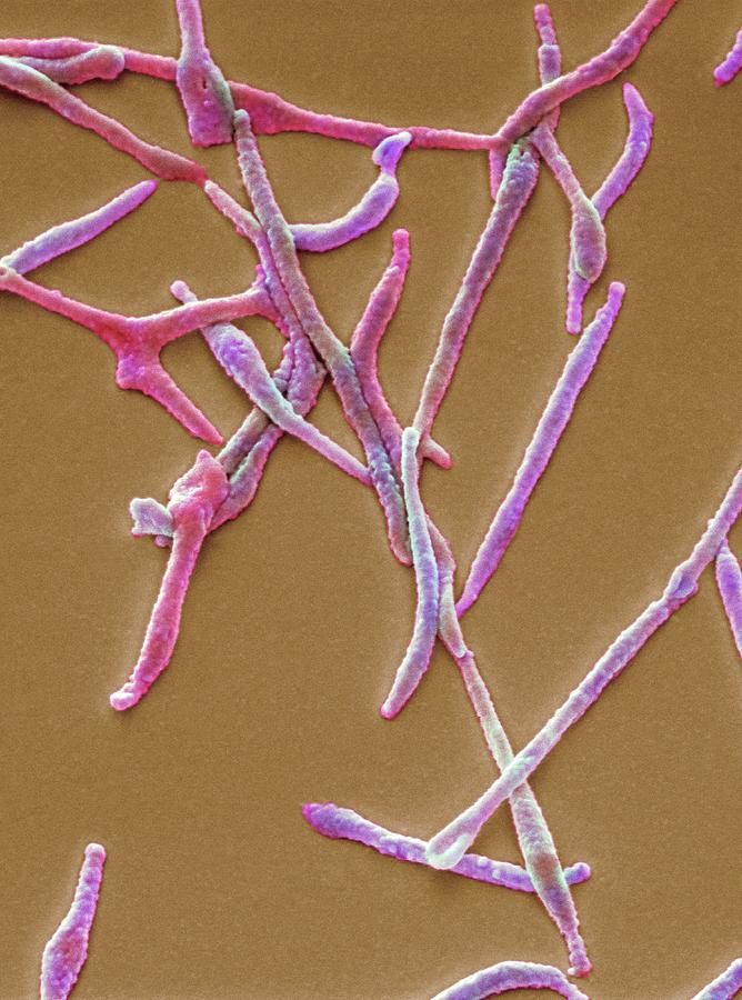 Mycoplasma Pneumoniae Photograph By Steve Gschmeissner Pixels