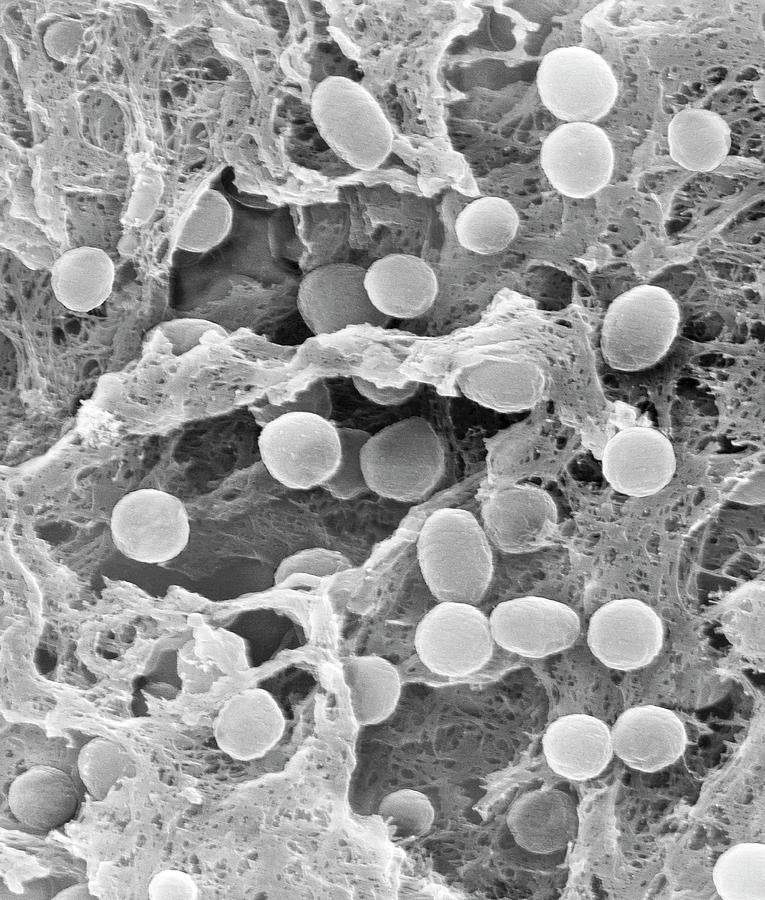 Acidobacterium Sp Soil Prokaryote Photograph By Dennis Kunkel