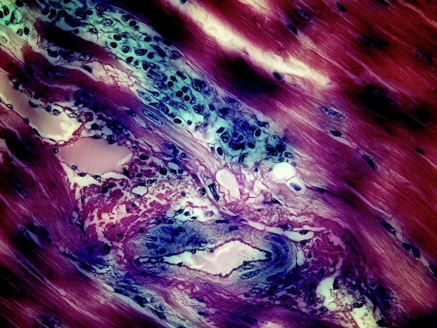 Cardiac Muscle And Other Tissues Photograph By John Griffin University