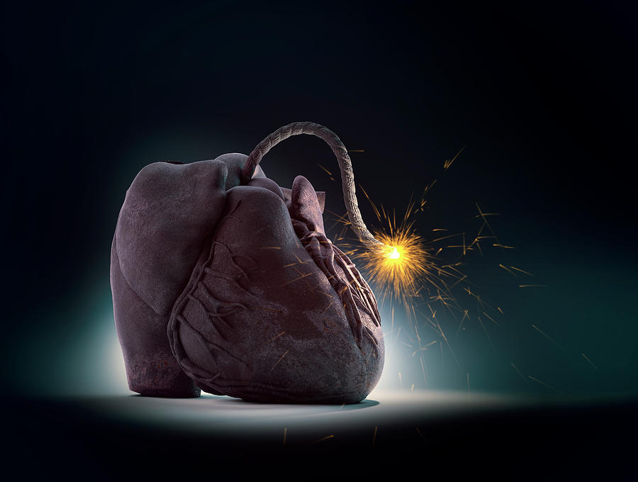 Cardiovascular Disease Photograph By Andrzej Wojcicki Fine Art America