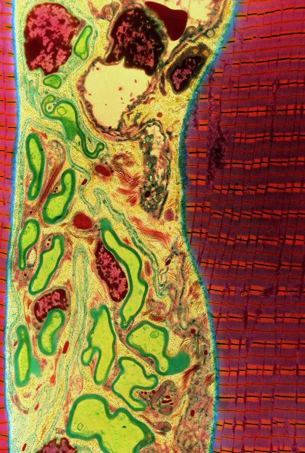 Coloured Tem Of Skeletal Muscle And Nerve Fibres Photograph By Steve