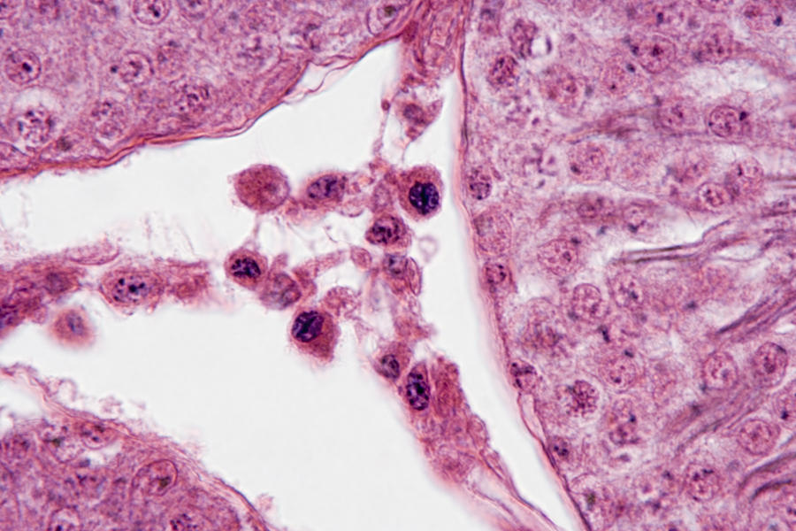 Cross Section Of Seminiferous Tubules Photograph By Science Stock