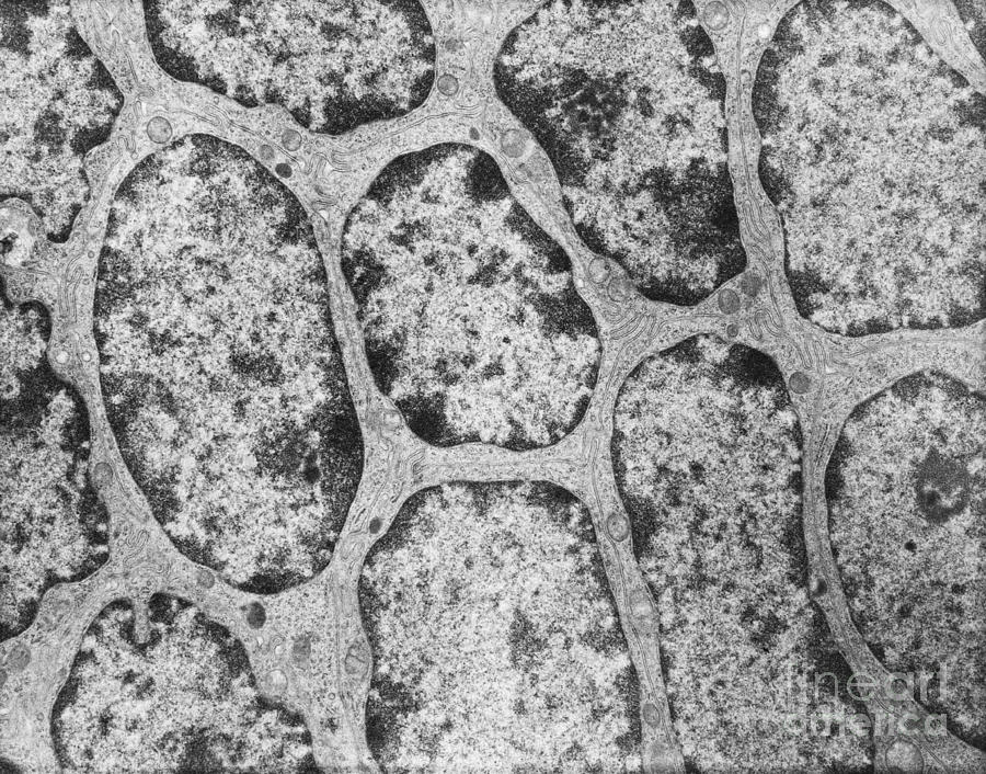 Epithelium Of Human Epididymis Tem Photograph By David M Phillips