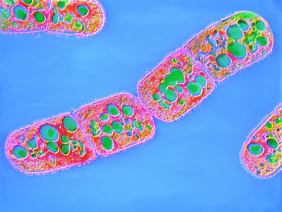 F Colour Tem Of Bacillus Megaterium Photograph By Cnri Science Photo