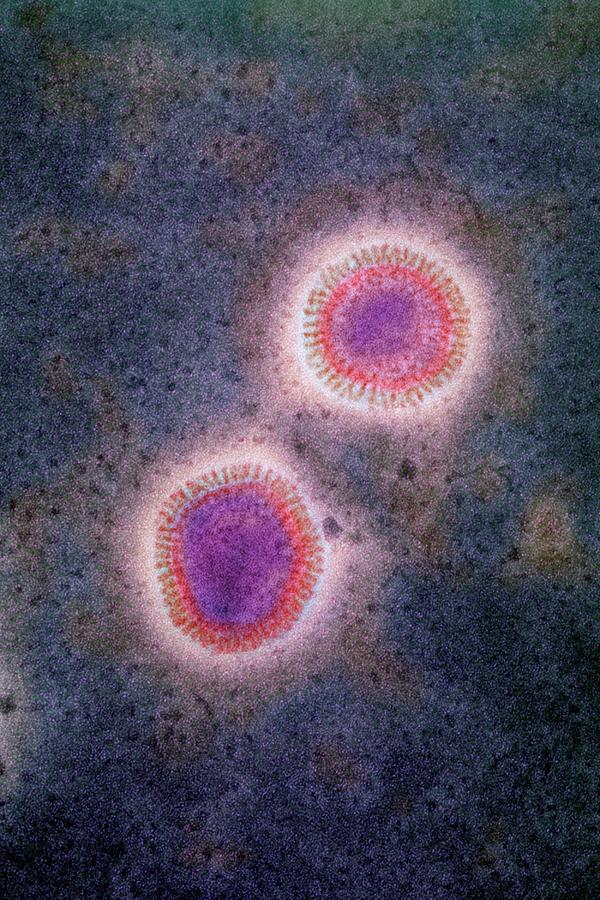 Influenza Virus Photograph By A Dowsett Public Health England Science