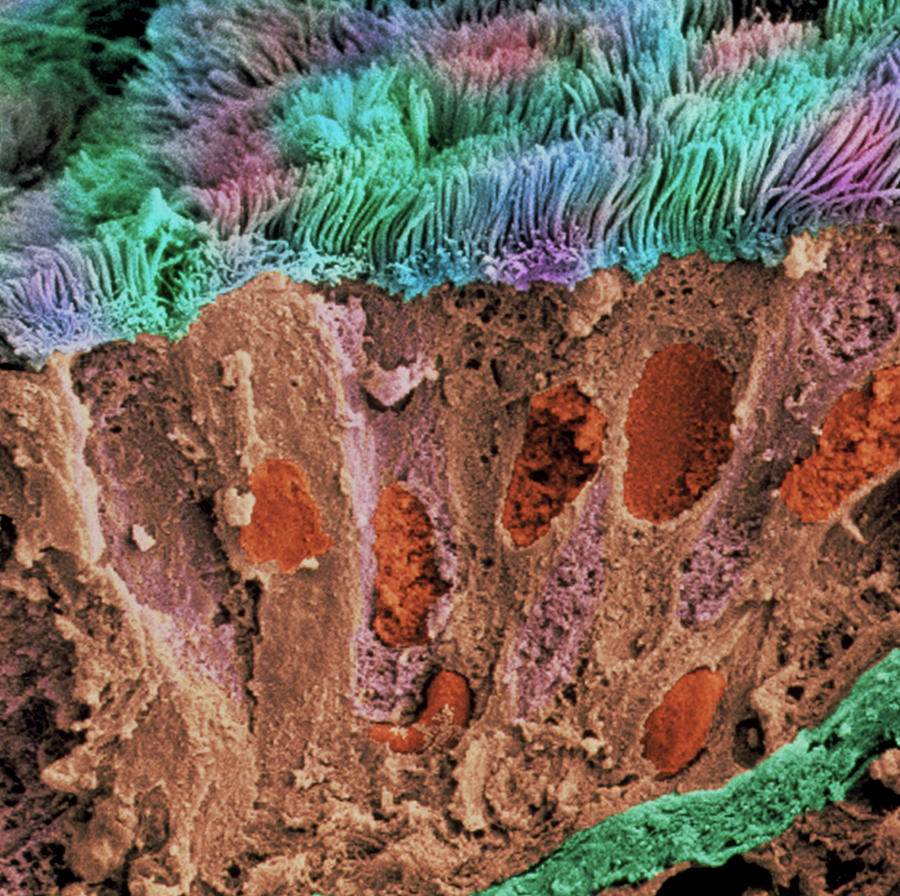 Sem Of Bronchial Epithelium Lining Lung By Science Photo Library