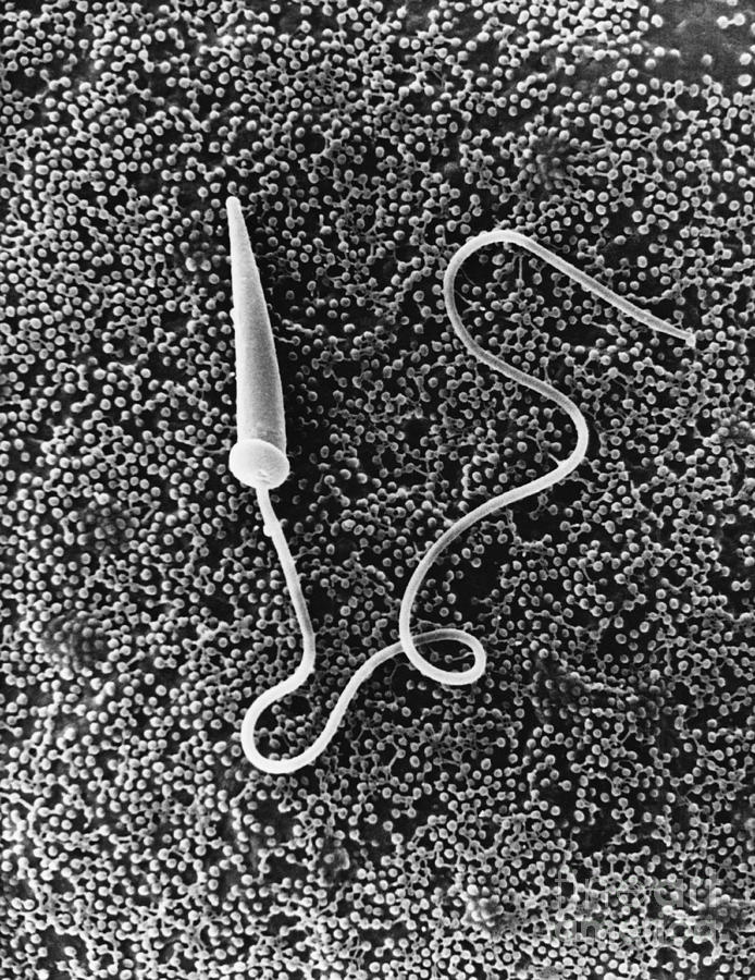 Starfish Sperm Sem Photograph By David M Phillips Pixels