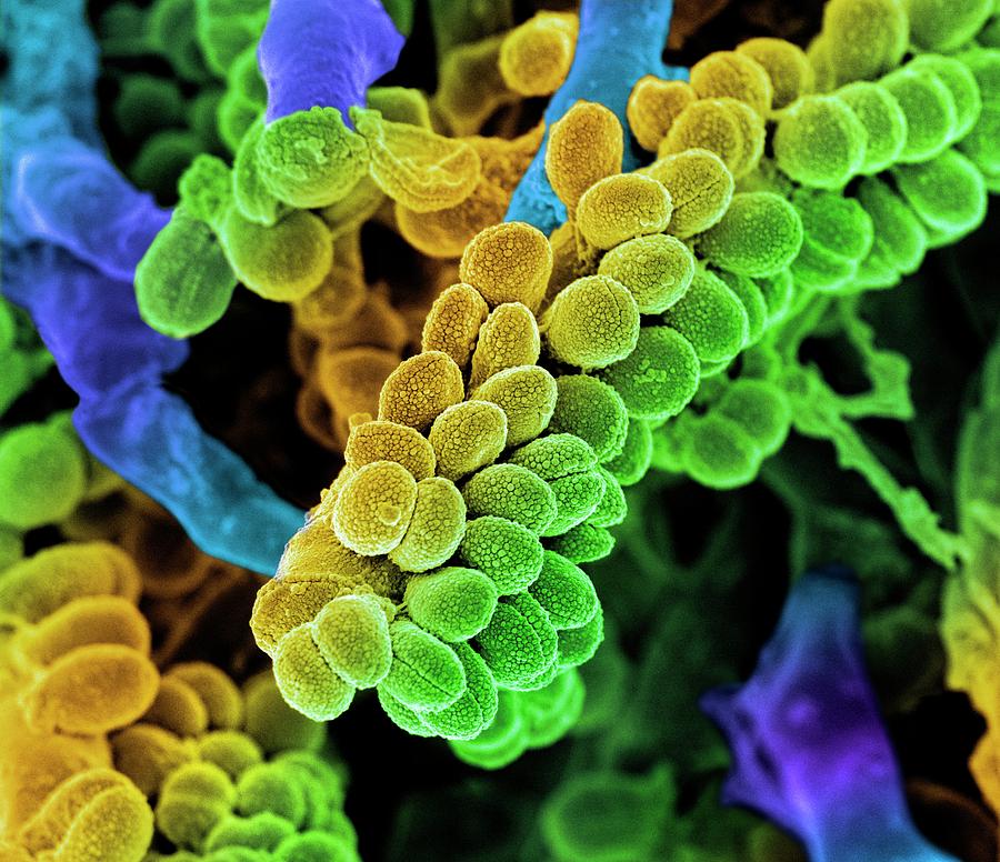 Streptococcus Bacteria Photograph By Science Photo Library Fine Art