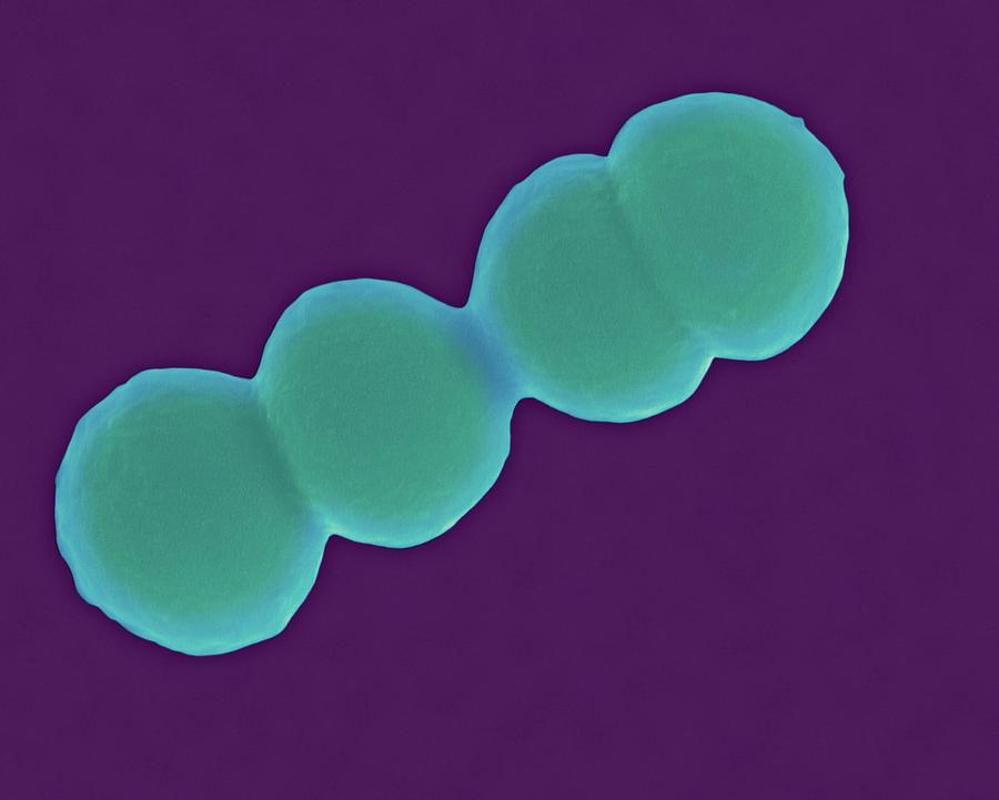 Streptococcus Pyogenes Photograph By Dennis Kunkel Microscopy Science Photo Library Pixels