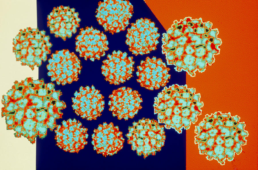 Coloured Tem Of Papilloma Viruses Photograph By Dr Linda Stannard Uct