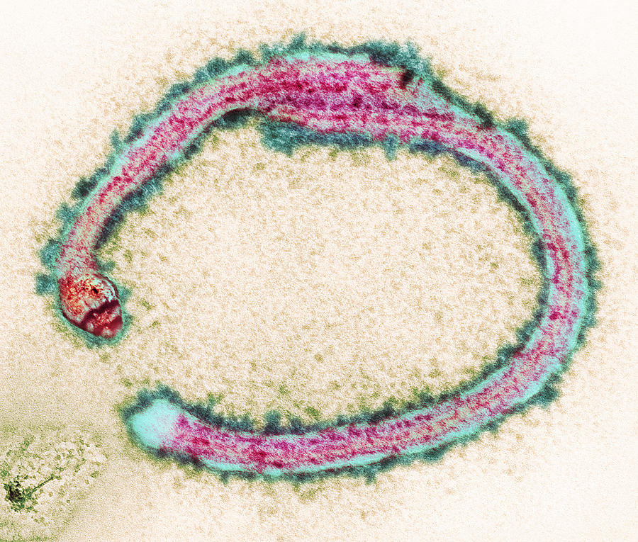  - 1-ebola-virus-particles-tem-hazel-appleton-centre-for-infectionshealth-protection-agency