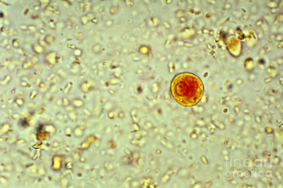 Entamoeba Histolytica Cyst With Label