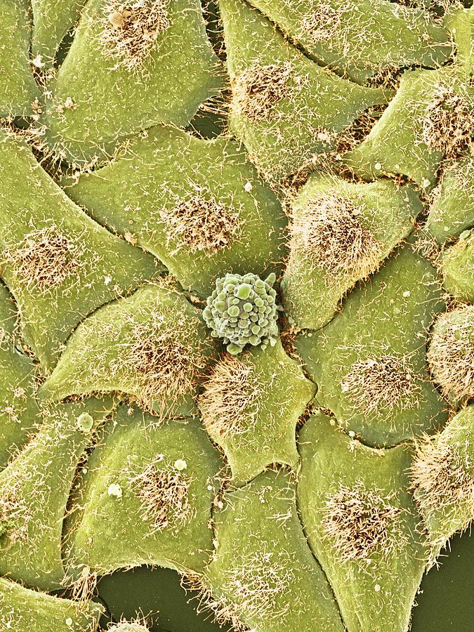 Hela Cells Sem Photograph By Thomas Deerinck Ncmir Fine Art America