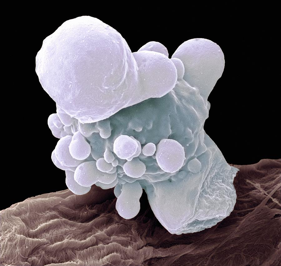 Neutrophil Sem Photograph By Steve Gschmeissner