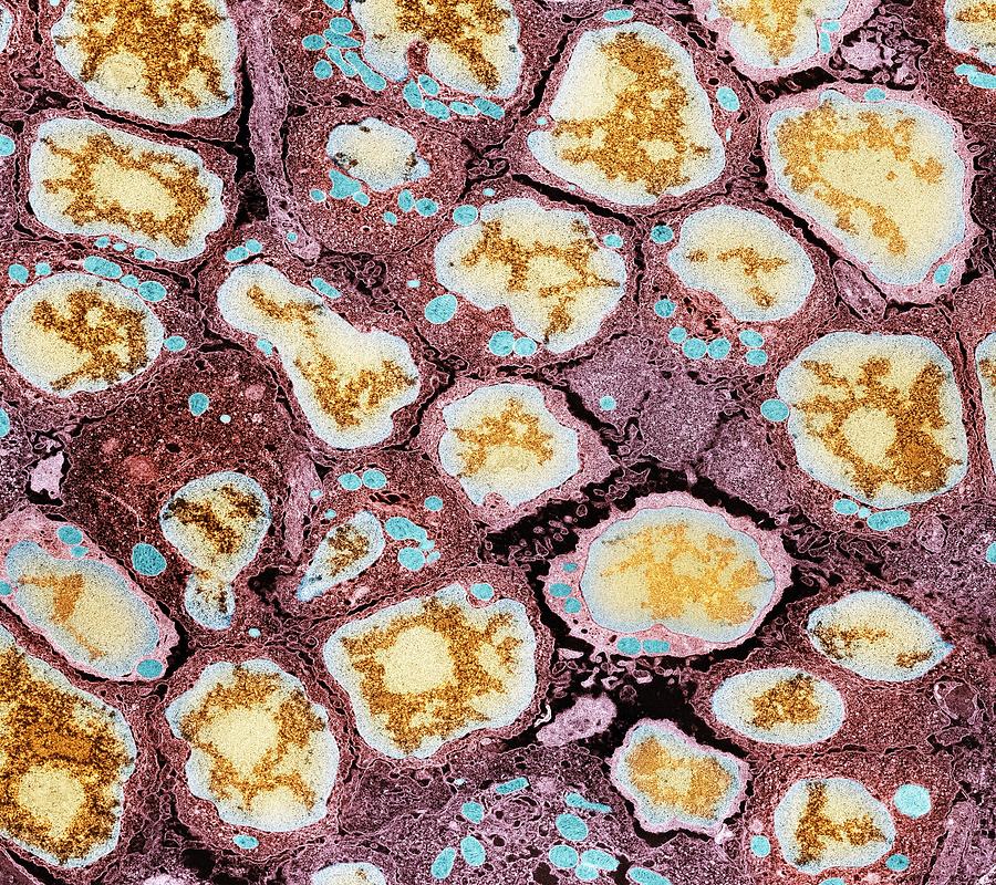 Spleen Cells Tem Photograph By Thomas Deerinck Ncmir Fine Art America