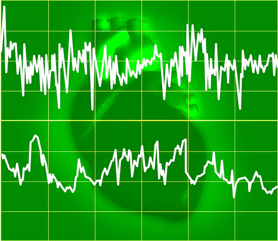 regular irregular heartbeat