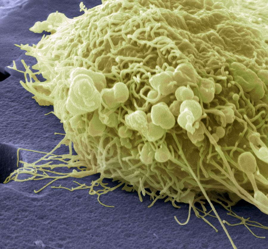 Migrating Breast Cancer Cell Sem Photograph By Steve Gschmeissner Pixels