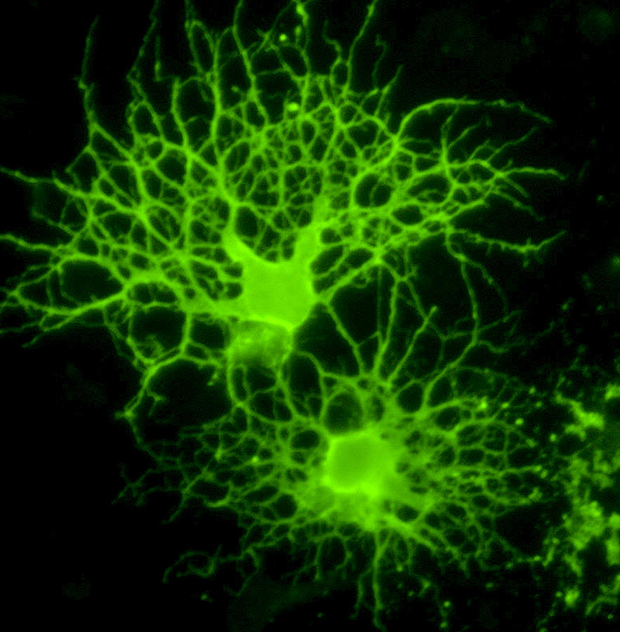 Oligodendrocyte Nerve Cells Photograph By Riccardo Cassiani Ingoni