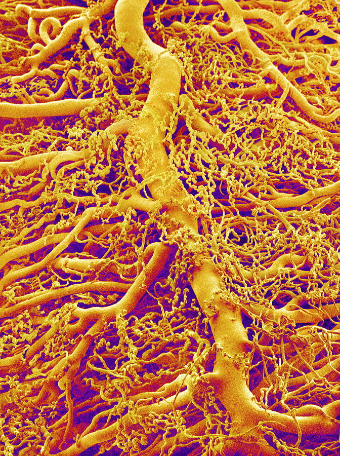 Blood Vessels Sem Photograph By Susumu Nishinaga Fine Art America