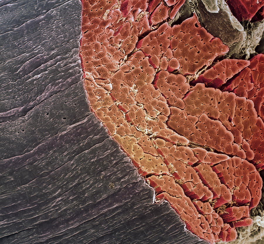 Skeletal Muscle Sem Photograph By Steve Gschmeissner Fine Art America