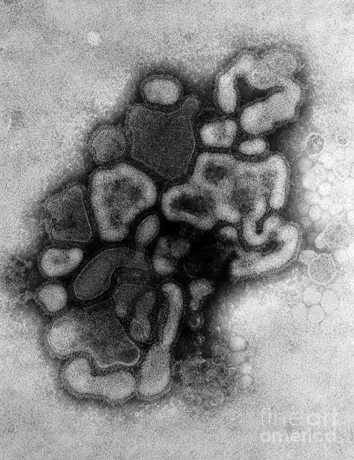 Hsw N Swine Flu Tem Photograph By Science Source