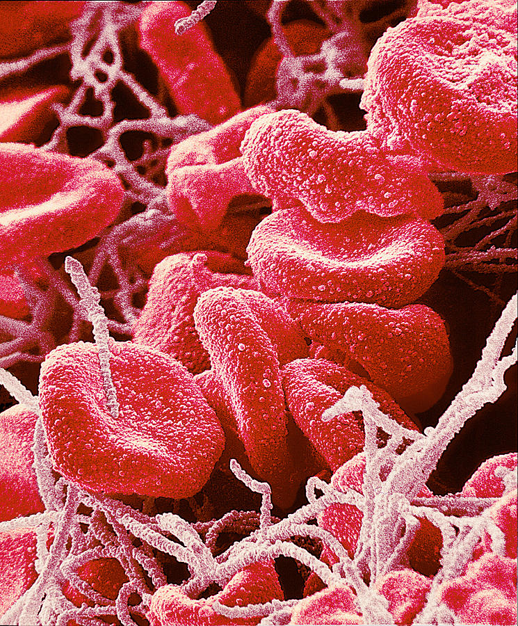 Red Blood Cells, Sem Photograph by Susumu Nishinaga