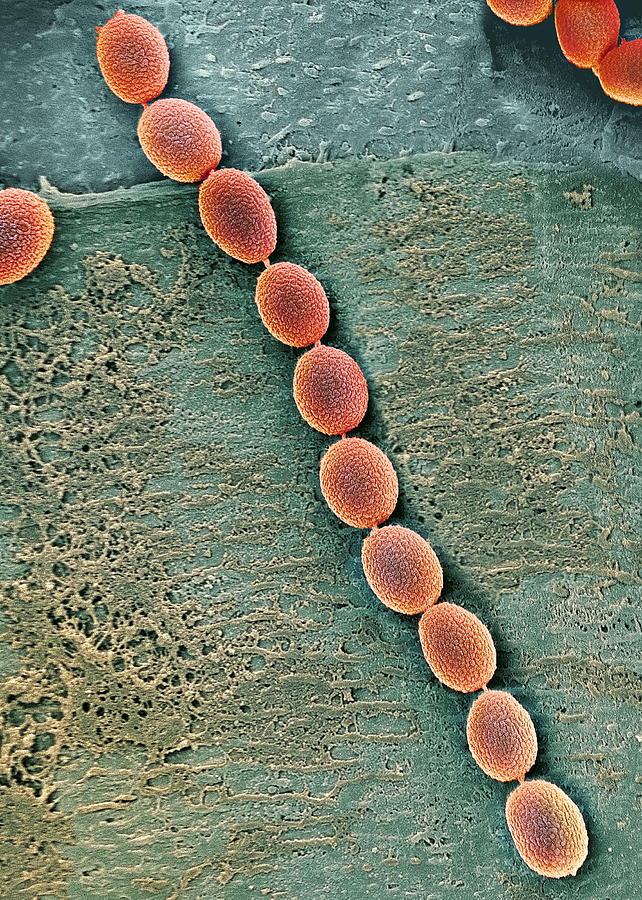 Fungal Spores Sem Photograph By Steve Gschmeissner